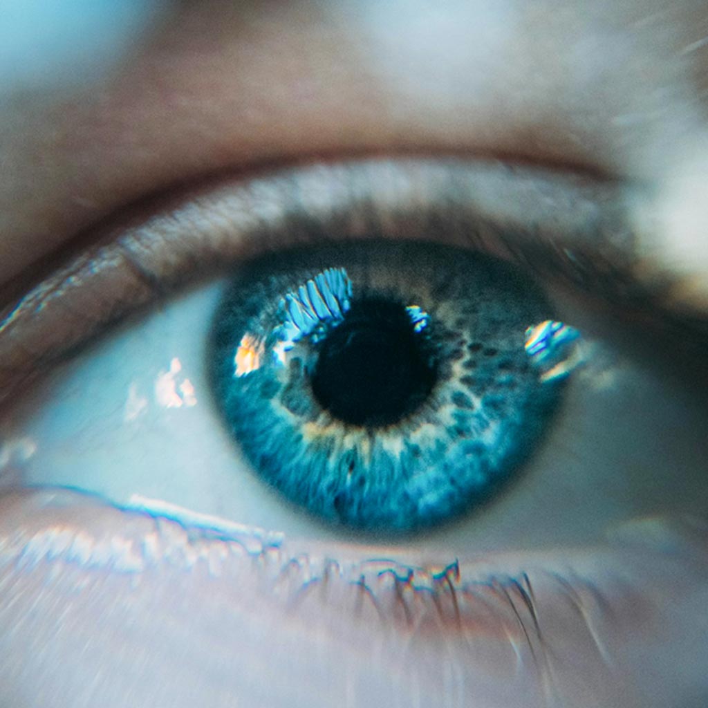 Lasik Eye Surgery in antalya, turkey at medpera. LASIK surgery consultation for international patients in Antalya, Turkey