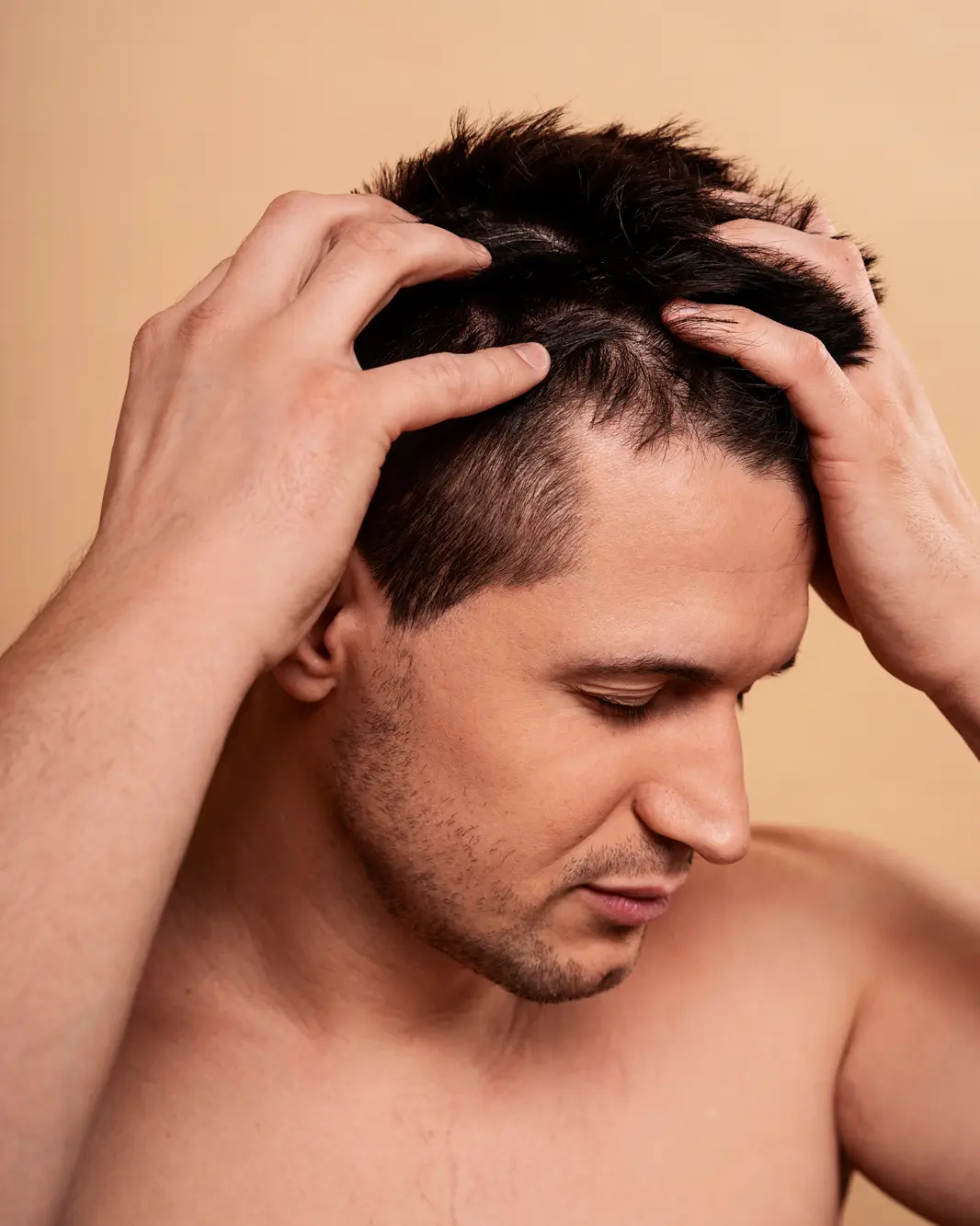 Hair Transplant | Dental & Aesthetic Clinics Medpera Hair Transplant