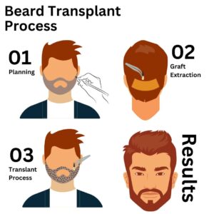 beard transplant process turkey